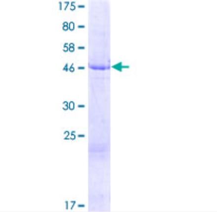 12.5% SDS-PAGE Stained with Coomassie Blue.